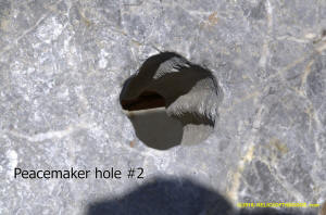 Peacemaker hole #2